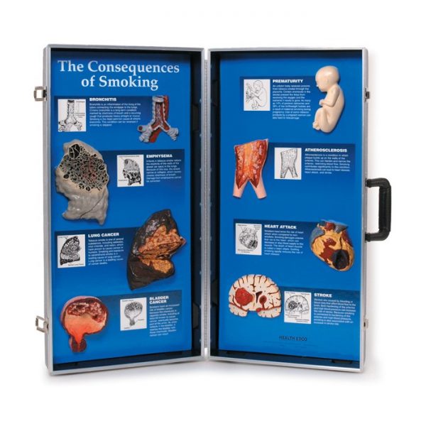 The Consequences of Smoking 3-D Display