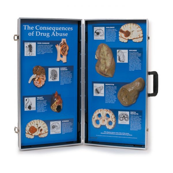 The Consequences of Drug Abuse 3-D Display